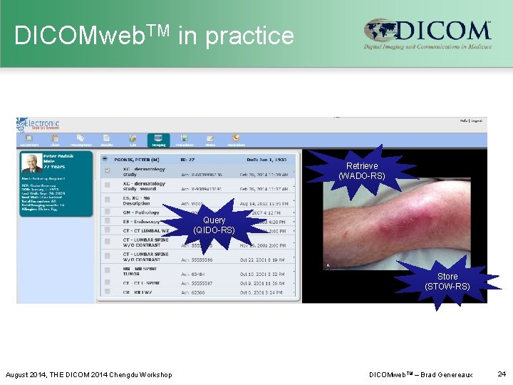 DICOMweb. TM in practice Retrieve (WADO-RS) Query (QIDO-RS) Store (STOW-RS) August 2014, THE DICOM