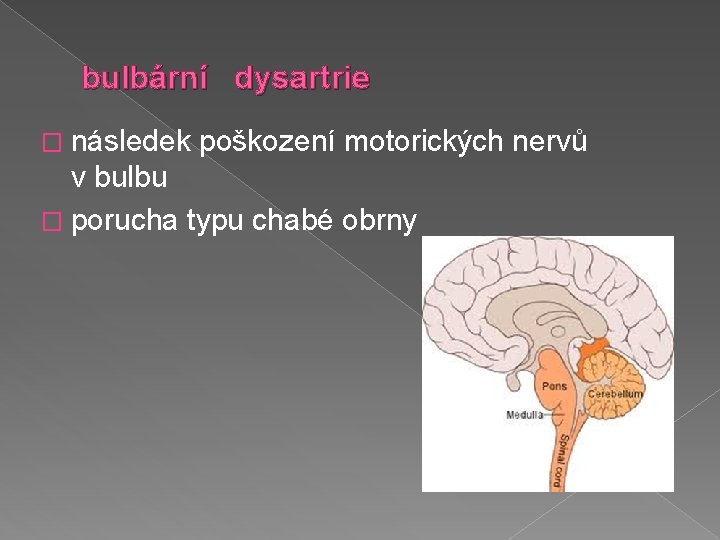 bulbární dysartrie � následek poškození motorických nervů v bulbu � porucha typu chabé obrny