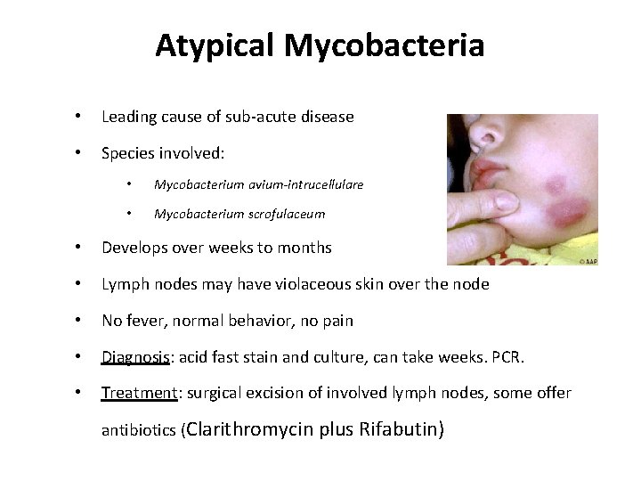 Atypical Mycobacteria • Leading cause of sub-acute disease • Species involved: • Mycobacterium avium-intrucellulare