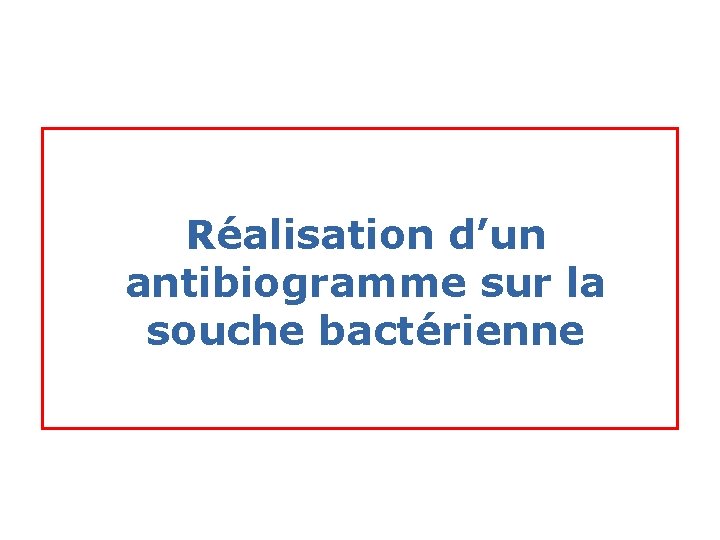 Réalisation d’un antibiogramme sur la souche bactérienne 