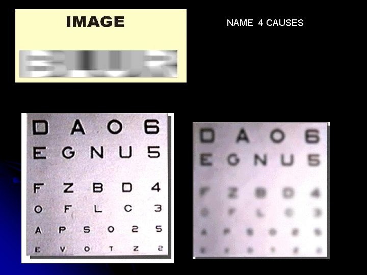 NAME 4 CAUSES NAME 4 CAUSES