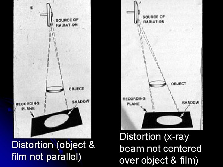 Distortion (object & film not parallel) Distortion (x-ray beam not centered over object & Distortion (object & film not parallel) Distortion (x-ray beam not centered over object &