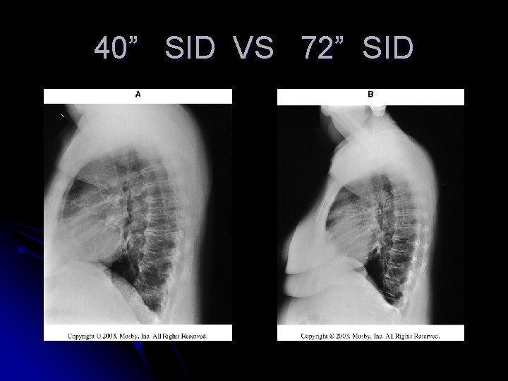 40” SID VS 72” SID 40” SID VS 72” SID