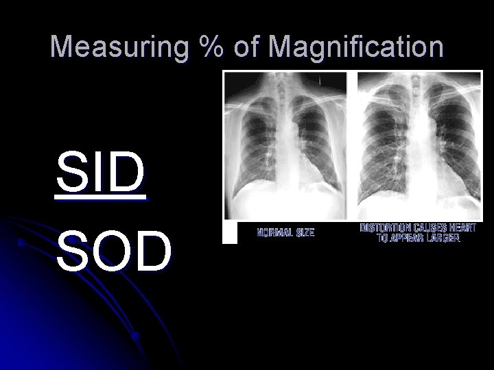 Measuring % of Magnification SID SOD 