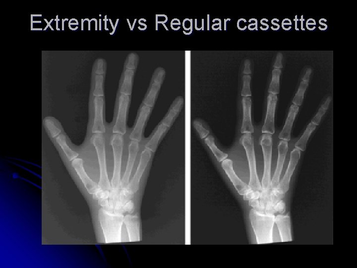 Extremity vs Regular cassettes 