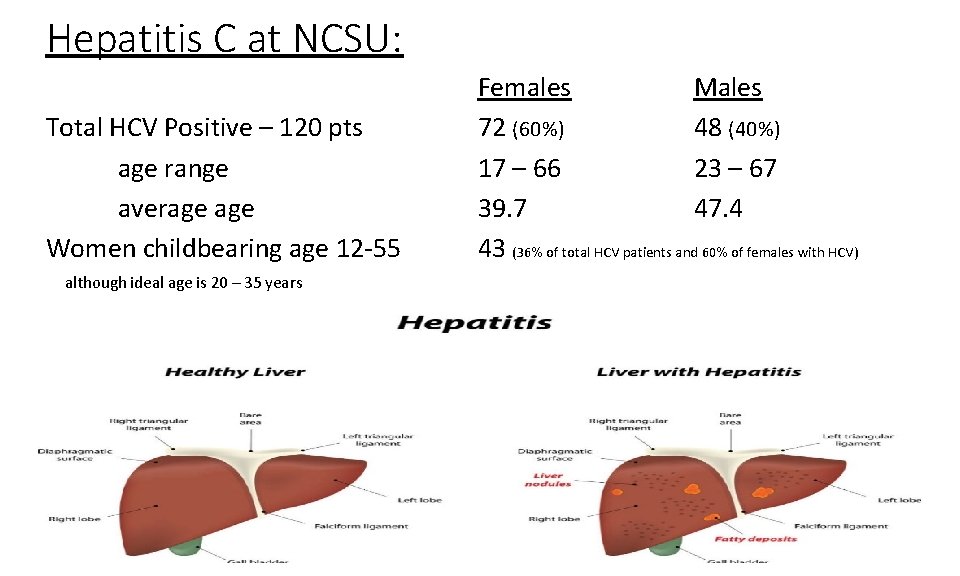 Hepatitis C at NCSU: Total HCV Positive – 120 pts age range average Women Hepatitis C at NCSU: Total HCV Positive – 120 pts age range average Women