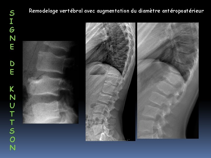 S I G N E D E K N U T T S O