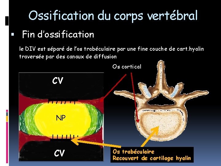 Ossification du corps vertébral Fin d’ossification le DIV est séparé de l’os trabéculaire par