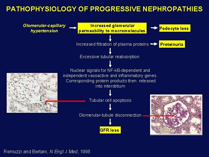 PATHOPHYSIOLOGY OF PROGRESSIVE NEPHROPATHIES Glomerular-capillary hypertension Increased glomerular permeability to macromolecules Increased filtration of