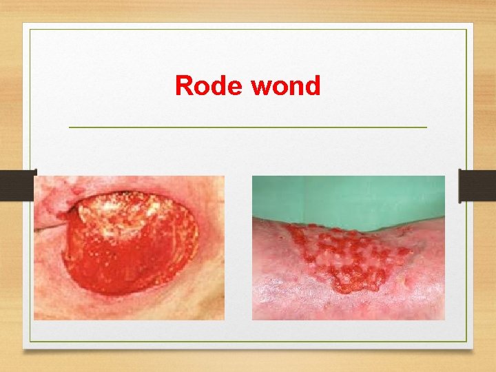 Rode wond Rode wond