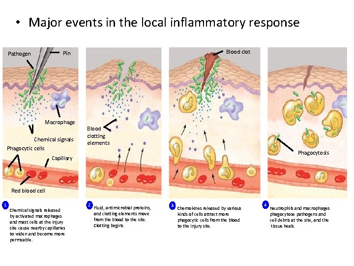  • Major events in the local inflammatory response Blood clot Pin Pathogen Macrophage