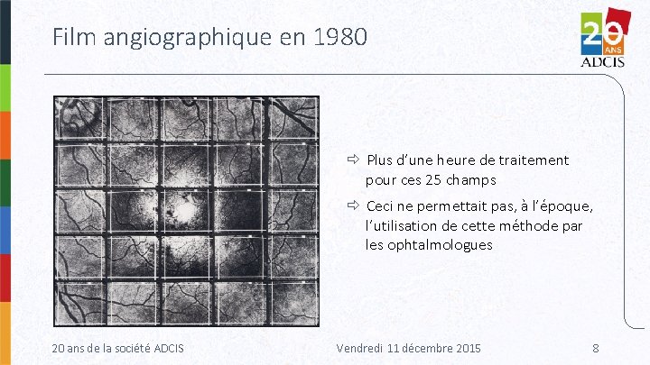 Film angiographique en 1980 Plus d’une heure de traitement pour ces 25 champs Ceci