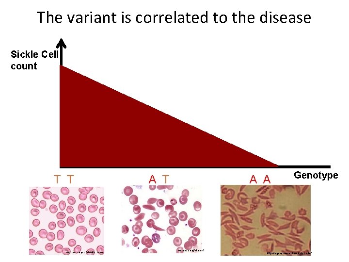 The variant is correlated to the disease Sickle Cell count T T micro-scopic. tumblr.