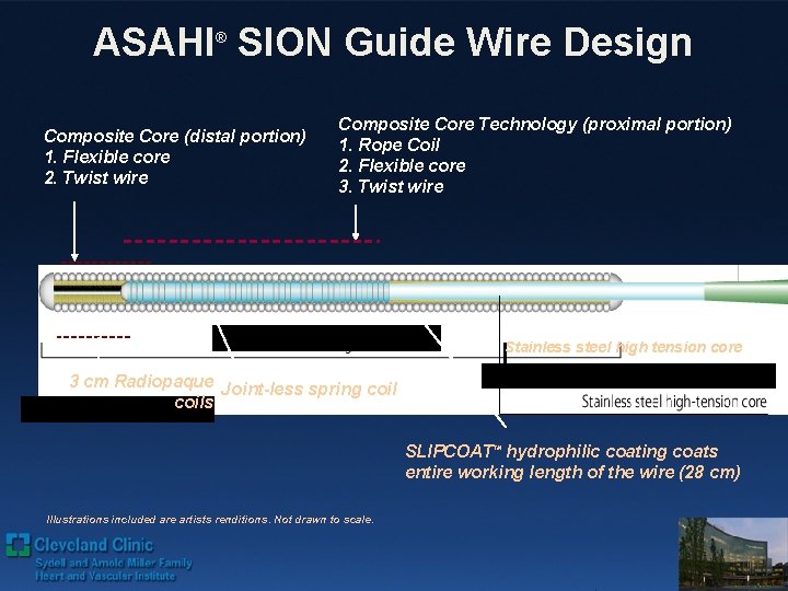 ASAHI SION Guide Wire Design ® Composite Core (distal portion) 1. Flexible core 2.