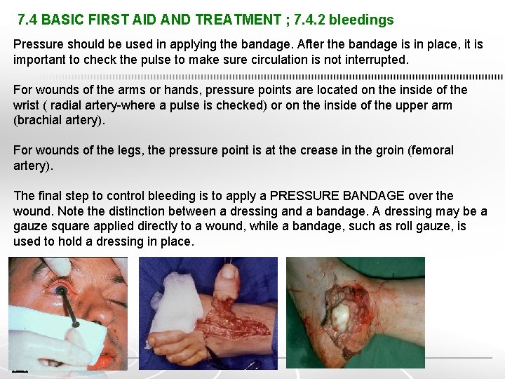 7. 4 BASIC FIRST AID AND TREATMENT ; 7. 4. 2 bleedings Pressure should