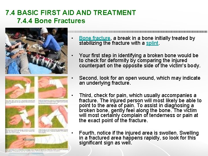 7. 4 BASIC FIRST AID AND TREATMENT 7. 4. 4 Bone Fractures • Bone
