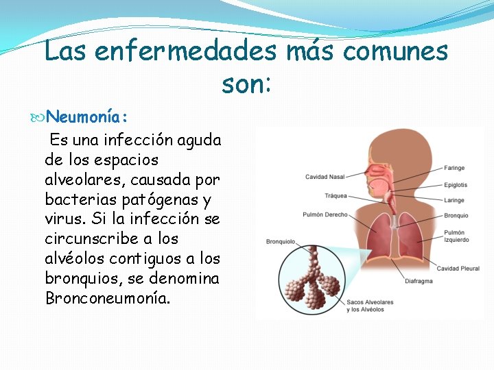 Las enfermedades más comunes son: Neumonía: Es una infección aguda de los espacios alveolares, Las enfermedades más comunes son: Neumonía: Es una infección aguda de los espacios alveolares,