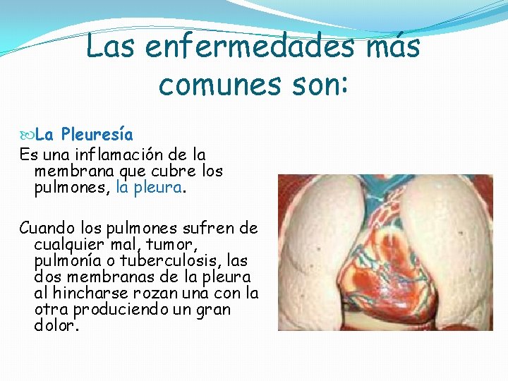 Las enfermedades más comunes son: La Pleuresía Es una inflamación de la membrana que Las enfermedades más comunes son: La Pleuresía Es una inflamación de la membrana que