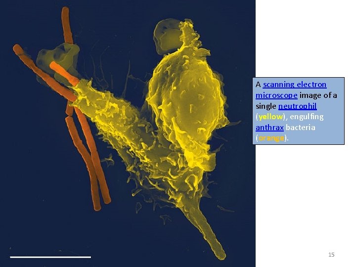 A scanning electron microscope image of a single neutrophil (yellow), engulfing anthrax bacteria (orange).