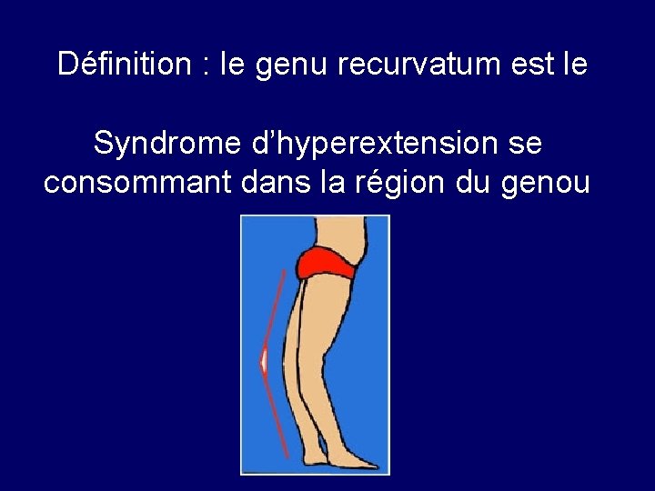  Définition : le genu recurvatum est le Syndrome d’hyperextension se consommant dans la