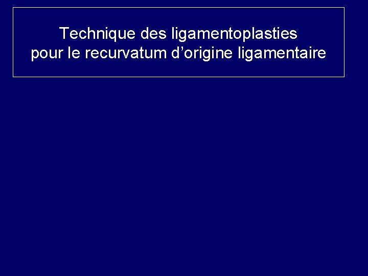 Technique des ligamentoplasties pour le recurvatum d’origine ligamentaire 