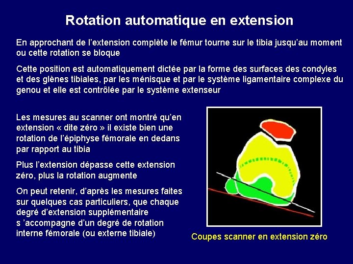  Rotation automatique en extension En approchant de l’extension complète le fémur tourne sur