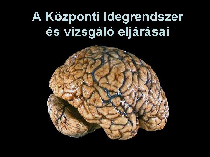 A Központi Idegrendszer és vizsgáló eljárásai 