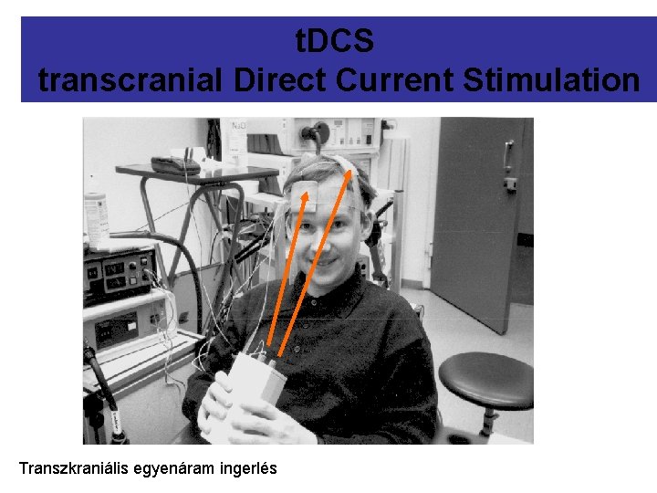 Neuroplasticityt. DCS induced by DCtranscranial Stimulation stimulation. Direct of the. Current human cortex Transzkraniális