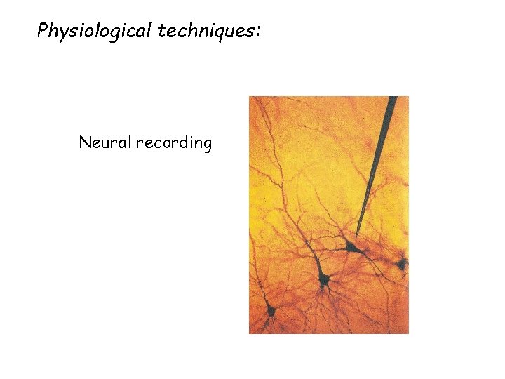 Physiological techniques: Neural recording 