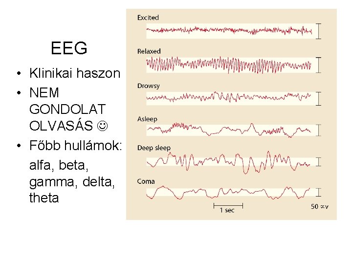 EEG • Klinikai haszon • NEM GONDOLAT OLVASÁS • Főbb hullámok: alfa, beta, gamma,