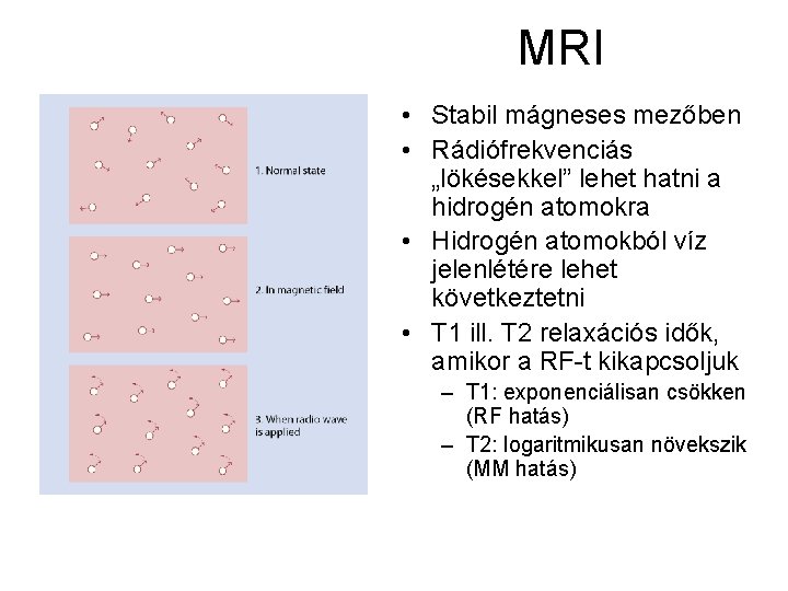 MRI • Stabil mágneses mezőben • Rádiófrekvenciás „lökésekkel” lehet hatni a hidrogén atomokra •