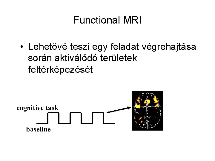 Functional MRI • Lehetővé teszi egy feladat végrehajtása során aktiválódó területek feltérképezését cognitive task