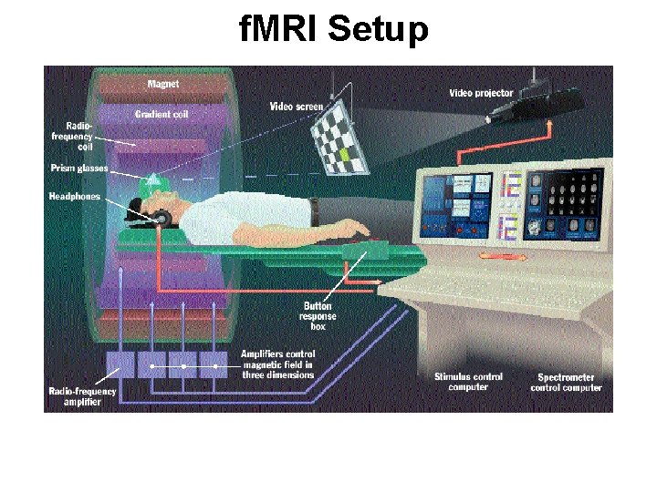 f. MRI Setup 