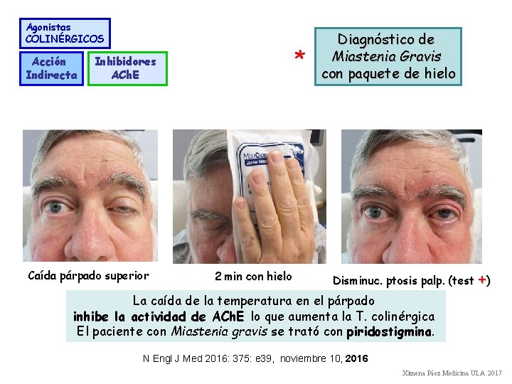 Agonistas COLINÉRGICOS Acción Indirecta Inhibidores ACh. E Caída párpado superior * 2 min con