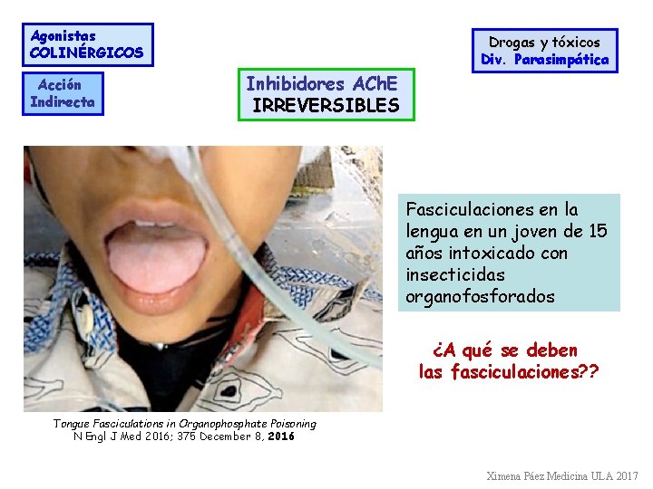 Agonistas COLINÉRGICOS Acción Indirecta Drogas y tóxicos Div. Parasimpática Inhibidores ACh. E IRREVERSIBLES Fasciculaciones