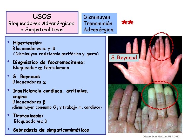 USOS Bloqueadores Adrenérgicos o Simpaticolíticos • Disminuyen Transmisión Adrenérgica ** Hipertensión: Bloqueadores a y