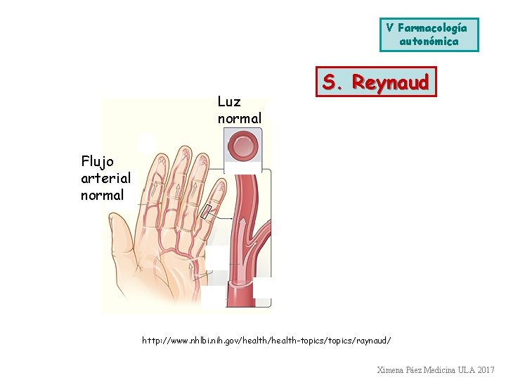 V Farmacología autonómica Luz normal S. Reynaud Luz cerrada Flujo arterial normal Vasoconstricción extrema V Farmacología autonómica Luz normal S. Reynaud Luz cerrada Flujo arterial normal Vasoconstricción extrema