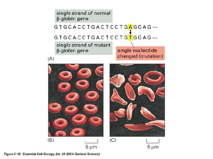 06_19_sickle_cell. jpg 