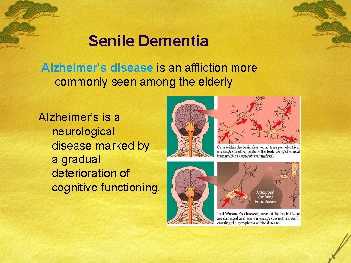 Senile Dementia Alzheimer’s disease is an affliction more commonly seen among the elderly. Alzheimer’s Senile Dementia Alzheimer’s disease is an affliction more commonly seen among the elderly. Alzheimer’s