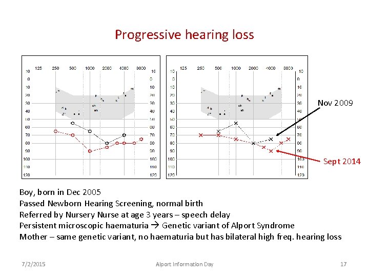 Progressive hearing loss Nov 2009 Sept 2014 Boy, born in Dec 2005 Passed Newborn