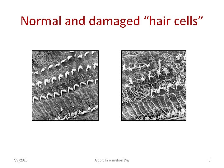 Normal and damaged “hair cells” 7/2/2015 Alport Information Day 8 