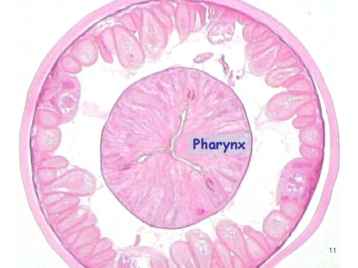 Pharynx 11 