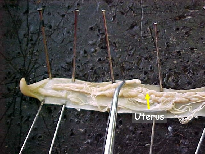 Uterus 25 