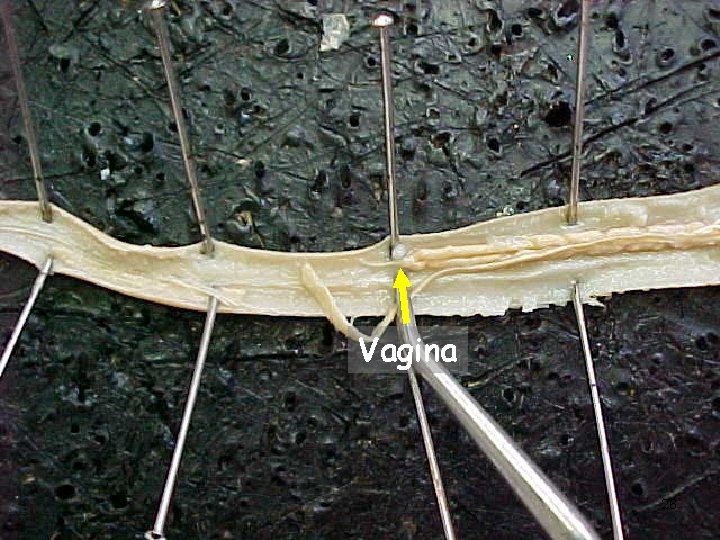 Vagina 26 