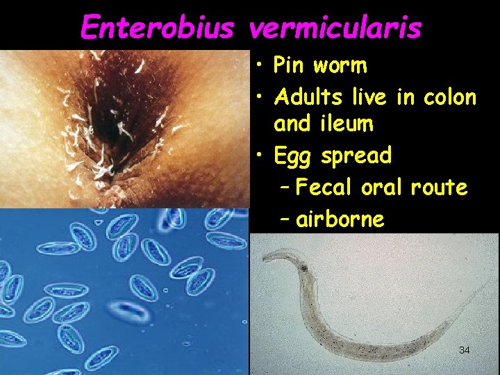 Enterobius vermicularis • Pin worm • Adults live in colon and ileum • Egg