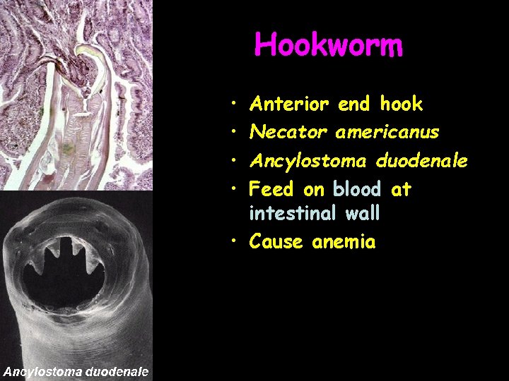 Hookworm • • Anterior end hook Necator americanus Ancylostoma duodenale Feed on blood at