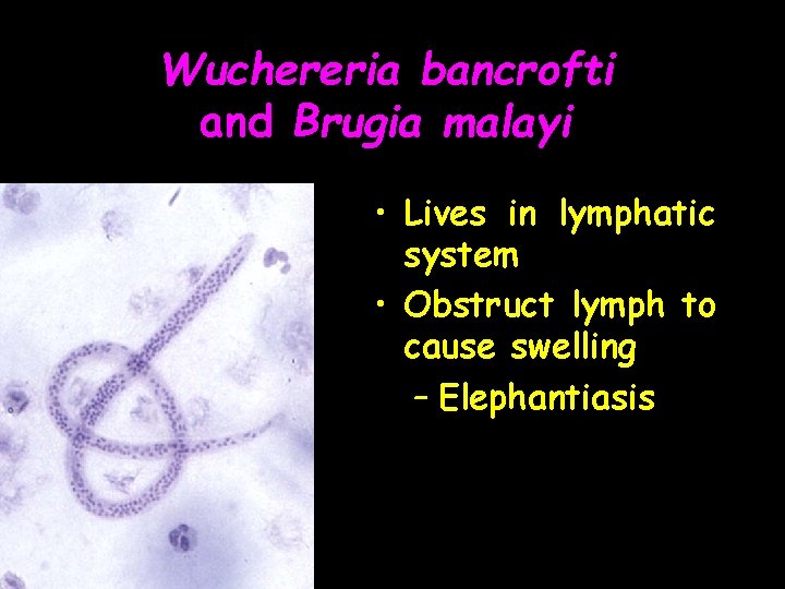 Wuchereria bancrofti and Brugia malayi • Lives in lymphatic system • Obstruct lymph to