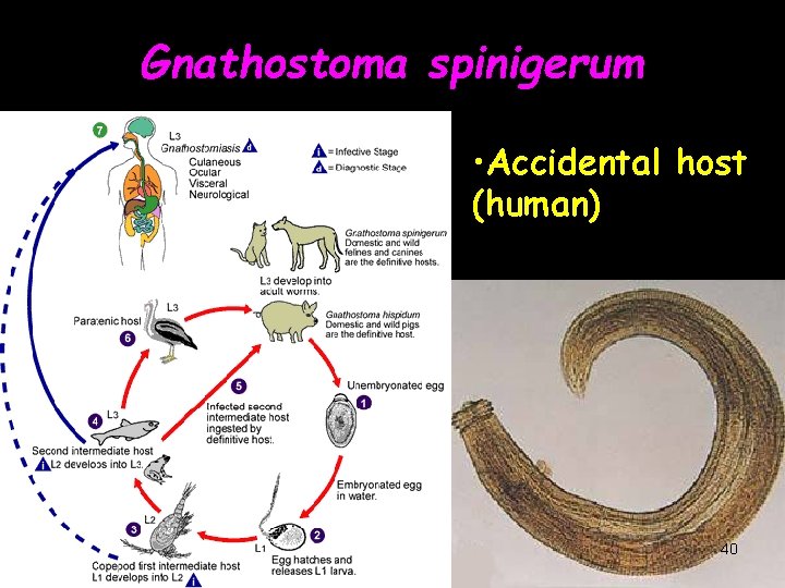 Gnathostoma spinigerum • Accidental host (human) 40 