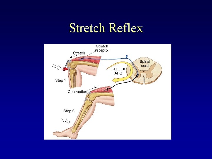 Stretch Reflex 