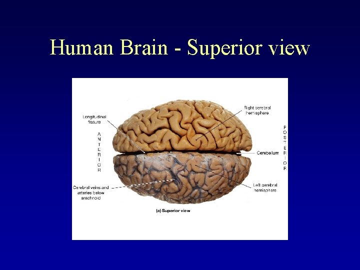 Human Brain - Superior view 